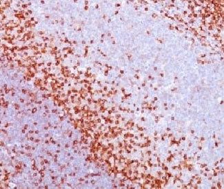 IHC testing of FFPE human spleen with CD43 antibody (clone CDLA43)