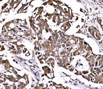 PSMD8 Antibody