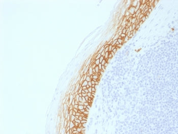 IHC testing of FFPE human tonsil with recombinant CD44v9 antibody (clone CD44v9/2344R). Required HIE