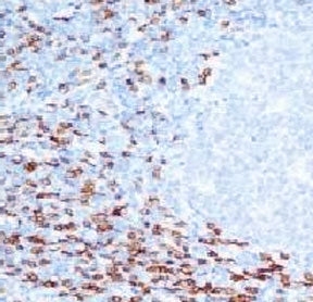 CD8A Antibody