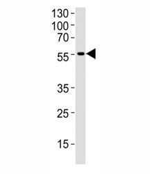 Western blot analysis of human brain tissue lysate using DCX antibody at 1:1000. Predicted molecular