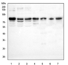 Western blot testing of 1) human HeLa, 2) human 293T, 3) human SiHa, 4) human A431, 5) rat brain, 6)