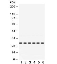 Western blot testing of 1) rat brain, 2) mouse brain, and human 3) HeLa, 4) SW620, 5) 293 and 6) Jur