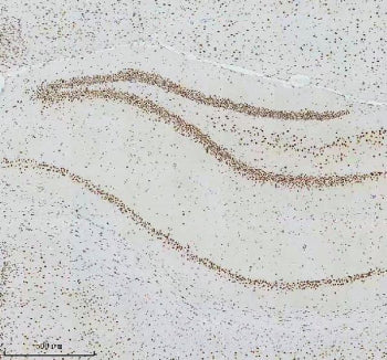 IHC staining of FFPE rat brain tissue with Cyclin dependent kinase 9 antibody, HRP-secondary and DAB