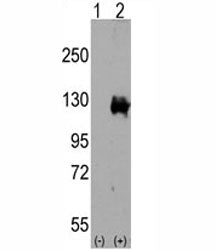 Western blot analysis of TRPM8 antibody and 293 cell lysate either nontransfected (Lane 1) or transi