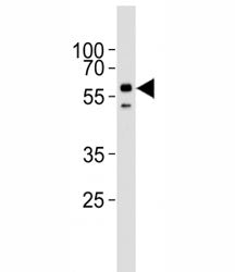 Activin receptor-like kinase 2 Antibody (ALK2)