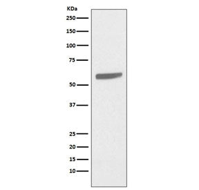 Western blot testing of human A431 cell lysate with Keratin 5 antibody. Predicted molecular weight: 