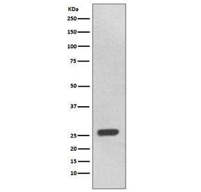 Western blot testing of human 293T cell lysate with UCHL3 antibody. Predicted molecular weight ~26 k