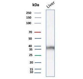 Western blot testing of human liver tissue lysate using AKR1C1 antibody (clone AKR1C1/9063). Predict