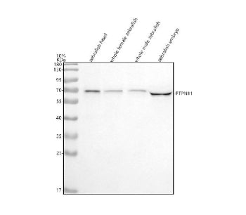 Western blot analysis of Shp2/PTPN11 protein using Zebrafish Shp2 antibody and 1) zebrafish head 2) 