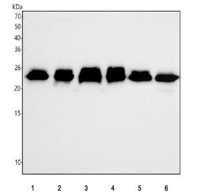 Western blot testing of 1) human 293T, 2) human HepG2, 3) human A549, 4) human RT4, 5) rat RH35 and 