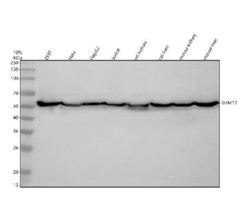 Western blot analysis of SHMT2 using anti-SHMT2 antibody. Electrophoresis was performed on a 10% SDS