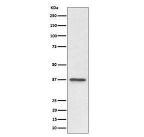 Western blot testing of human U-87 MG cell lysate with C3orf38 antibody. Predicted molecular weight 