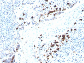 IHC staining of FFPE human tonsil with human recombinant IgA Heavy Chain antibody (clone rHISA43). H
