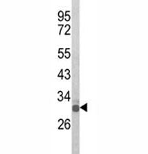 Olig3 Antibody