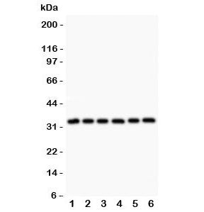 Western blot testing of MyD88 antibody and Lane 1: rat heart; 2: human HeLa; 3: (h) MCF7; 4: (h) HEP