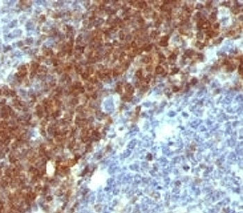Bcl-2 Antibody