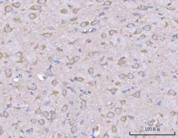 IHC staining of FFPE rat brain tissue with Liprin alpha 2 antibody. HIER: boil tissue sections in pH