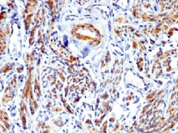 IHC testing of FFPE human uterus with recombinant Caldesmon antibody. Required HIER: boil tissue sec