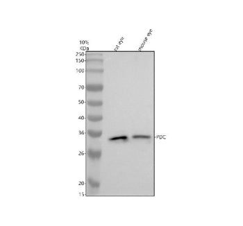 Western blot analysis of PDC using anti-PDC antibody. Electrophoresis was performed on a 10% SDS-PAG