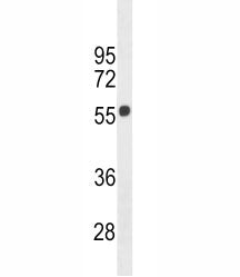 Cannabinoid Receptor 1 antibody western blot analysis in 293 lysate. Predicted molecular weight ~54 