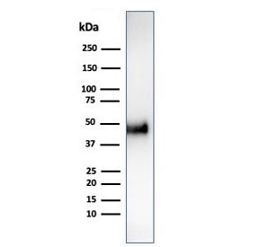 Western blot testing of human HCT-116 cell lysate using recombinant CCNE1 antibody (clone CCNE1/4935