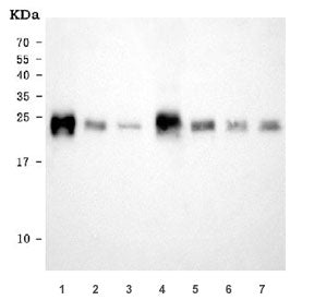 NDUFS8 Antibody / NADH-ubiquinone oxidoreductase 23 kDa subunit