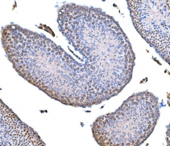 IHC staining of FFPE mouse testis tissue with Survivin antibody. HIER: boil tissue sections in pH8 E
