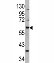 MDM2 Antibody, 0.08ml