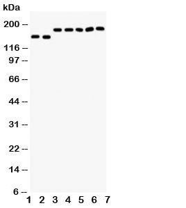 Western blot testing of DCC antibody and Lane 1: rat brain; 2: mouse brain; and human samples 3: U87