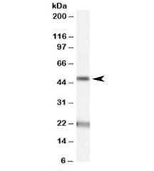 Western blot testing of human brain (substantia nigra) lysate with Acylglycerol kinase antibody at 1