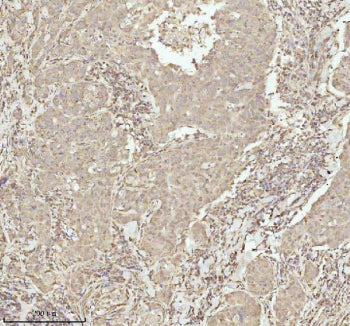IHC analysis of NDUFA9 using anti-NDUFA9 antibody. NDUFA9 was detected in a paraffin-embedded sectio