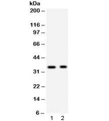 Western blot testing of 1) rat brain and 2) mouse brain lysate with Synaptophysin antibody. Predicte