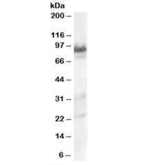Western blot testing of human heart lysate with TRAK1 antibody at 0.3ug/ml. Predicted molecular weig