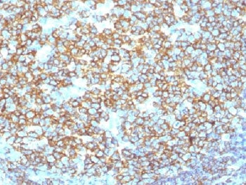 CD20 Antibody