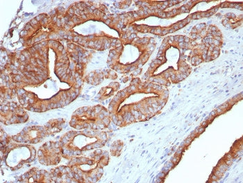 IHC staining of FFPE human prostate tissue with CD107a / LAMP1 antibody (clone LAMP1/7458). HIER: bo