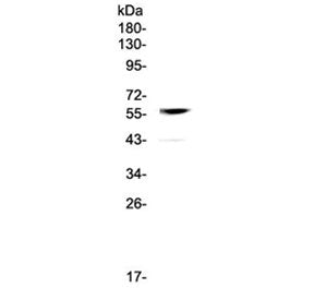 Western blot testing of human 22RV1 cell lysate with CB1 antibody at 0.5ug/ml. Predicted molecular w