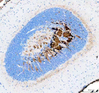 IHC staining of FFPE zebrafish brain tissue with Zebrafish ATP binding cassette E1 antibody, HRP-sec