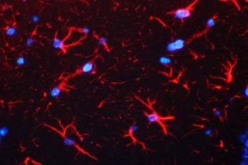 GFAP Antibody