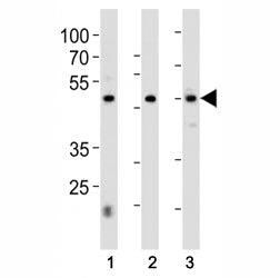 HNF4A antibody western blot analysis in 1) 293, 2) HepG2 cell line and 3) rat liver tissue lysate. P