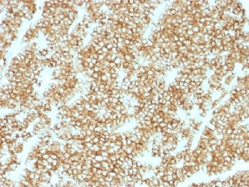 IHC testing of FFPE human parathyroid gland stained with recombinant PTH antibody (clone PTH/1717R).