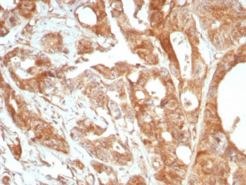 IHC staining of FFPE human lung tissue with Periostin antibody (clone POSTN/8951R). HIER: boil tissu
