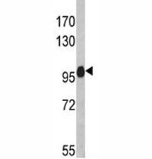 Western blot analysis of anti-NLRP12 antibody and HL-60 lysate. Predicted molecular weight: ~119kDa,