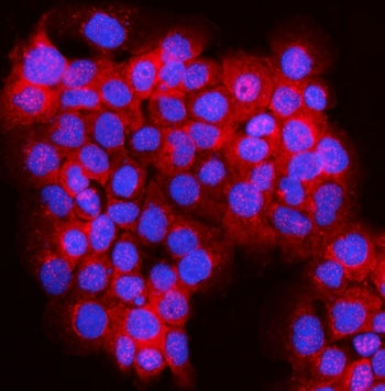 SPAG9 Antibody / JIP-4 / JLP