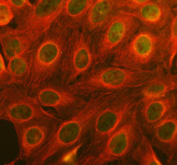 Immunofluorescent staining of FFPE human U-2 OS cells with EGR2 antibody (green) and Alpha Tubulin m