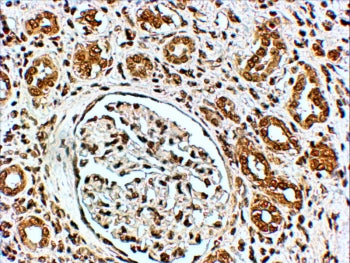 VPS41 Antibody