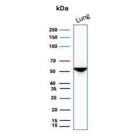 Western blot testing of human lung tissue lysate with Alpha 1 Antitrypsin antibody. Expected molecul