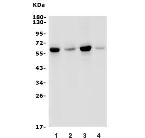 Western blot testing of human 1) HepG2, 2) K562, 3) SW620 and 4) A431 lysate with GRB7 antibody. Pre