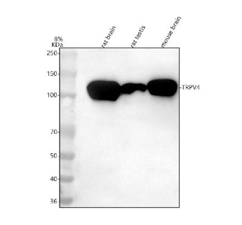 Western blot analysis of TRPV4 using anti-TRPV4 antibody. Lane 1: rat brain tissue lysates, Lane 2: 