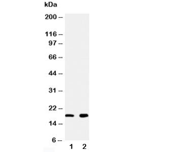 Western blot testing of Ly6AL antibody and Lane 1: rat heart; 2: rat liver tissue lysate. Predicted 